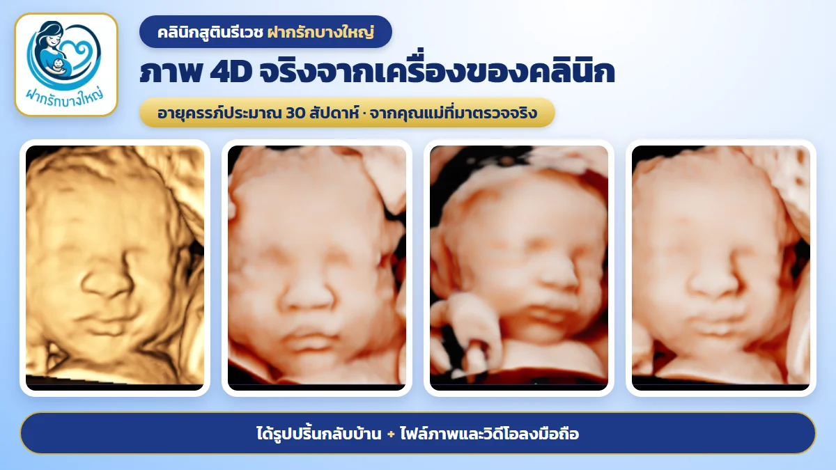ภาพอัลตราซาวด์ 4 มิติจริงจากเครื่องของคลินิกฝากรักบางใหญ่ อายุครรภ์ประมาณ 30 สัปดาห์